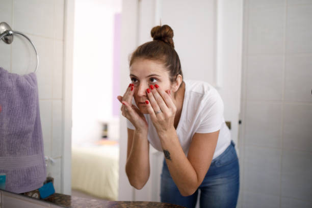 Banish Dark Circles