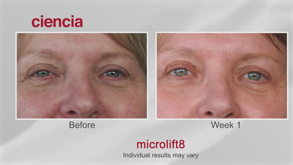 Microlift8  30 ml