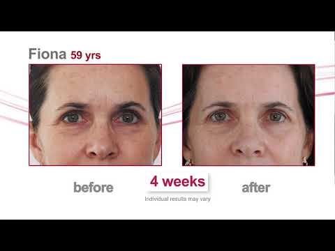Mature8 before and after - Ciencia Skincare